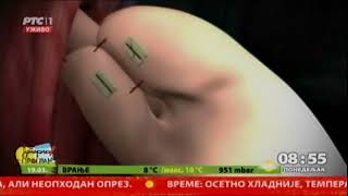 Vid 001 pamet srbije rts