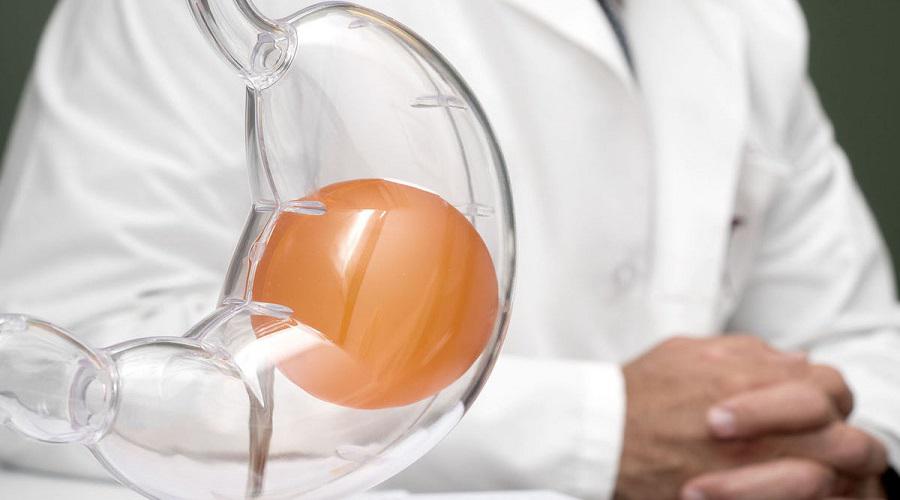 Želudačni balon reflux centar